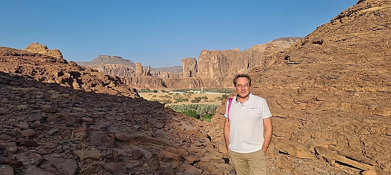 النمر يكشف عن أسباب تورم القدمين 