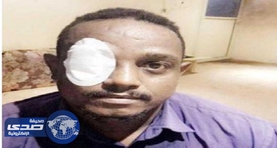 عامل يفقد نصف بصره بعد شجار بـ " العقال الطائر " في جدة