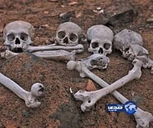 إستخراج عظما علق بحلق طفل دون تدخل جراحى فى مستشفي الأفلاج