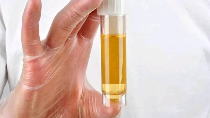 استشارية: الزلازل في البول مؤشر للإصابة بـ 3 أمراض