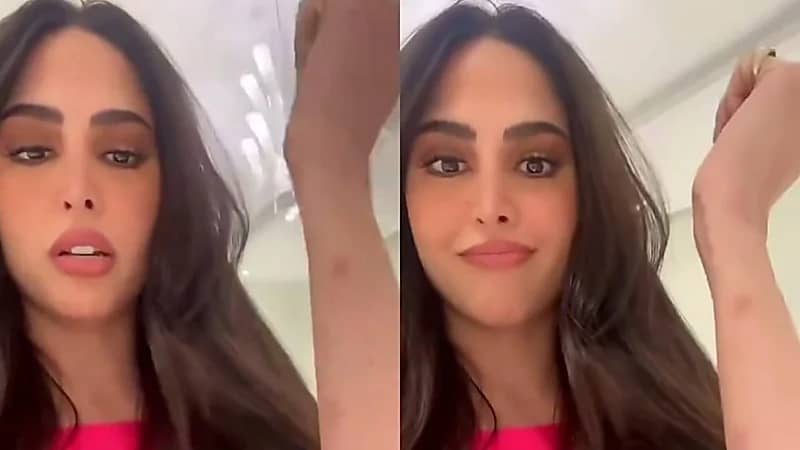 فوز الفهد تثير الجدل بوجود كدمات في يدها.. فيديو