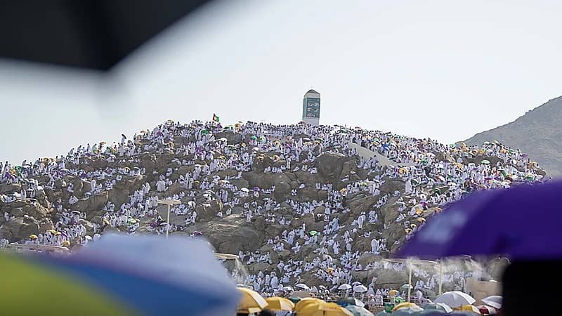 إنقاذ حياة حاجة تركية جراء نزيف حاد