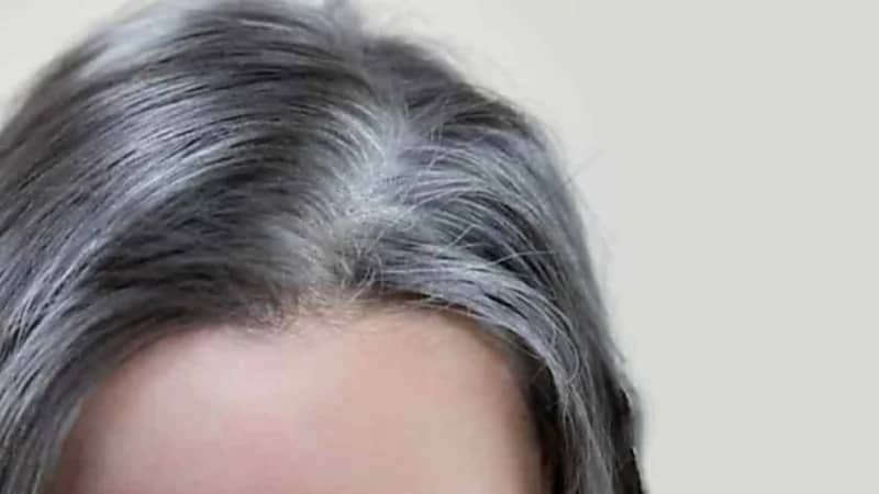 4 علاجات منزلية للتخلص من الشيب