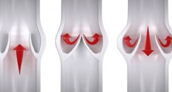 4 نصائح تضمن لك الوقاية من دوالي الساقين