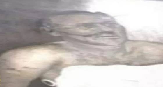 صورة حديثة لجثمان علي عبدالله صالح في المستشفى