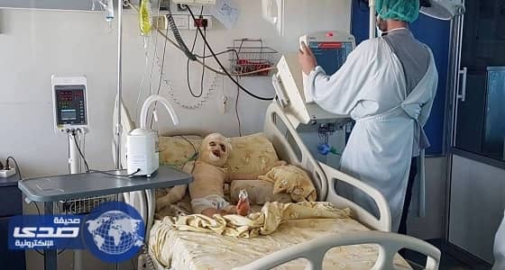 ⁠⁠⁠⁠⁠بالفيديو.. طفلة تسقط في وعاء زيت مغلي