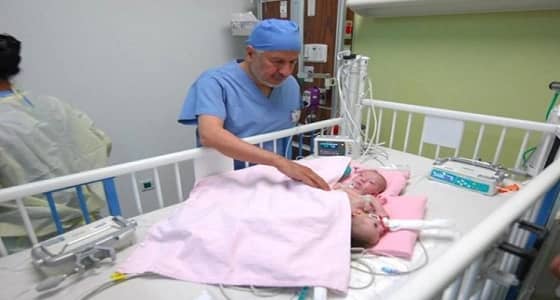 انتهاء عملية فصل التوأم الفلسطيني