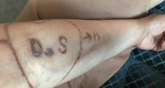 مجمع الأمل بالرياض ينفذ حملته الثانية لإزالة الوشوم من أجساد 25 متعافيا