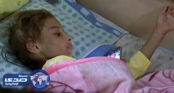 سيدة تعذب ابنتها بقلع الشعر ونزع الأظافر