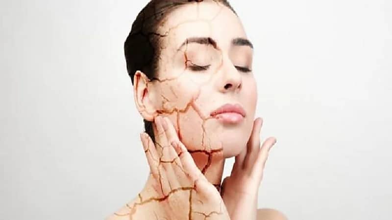 نصائح للتخلص من جفاف البشرة في الخريف