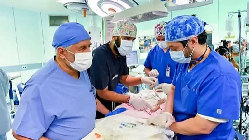 انتهاء عملية فصل التوأم الطفيلي المصري في وقت قياسي