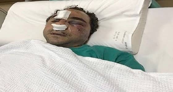 تحويل قضية المصري المتعدي عليه من كويتي إلى جنايات