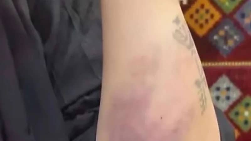 "العنف الأسري" يباشر الواقعة المتداولة حول تعرُّض امرأة للتعنيف