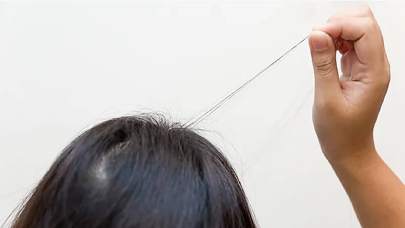 بالفيديو .. أعراض تدل على إصابة الطفل بهوس "نتف الشعر"