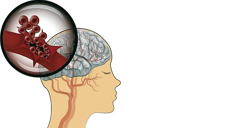 أطعمة مهمة تساعد في خفض الكوليسترول