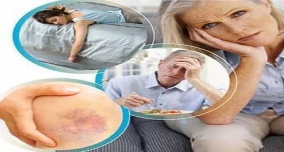 أعراض تؤكد إصابتك بتليف الكبد انتبهوا لها