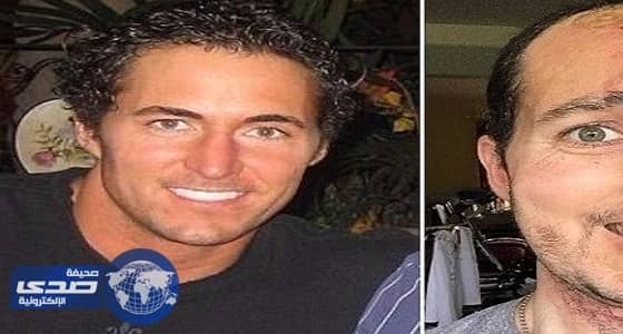 بسبب حالة مرضية نادرة أمريكي يفقد نصف وجهه
