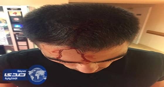 شاب مصري يلقن إسرائيليا " علقة " في ليتوانيا