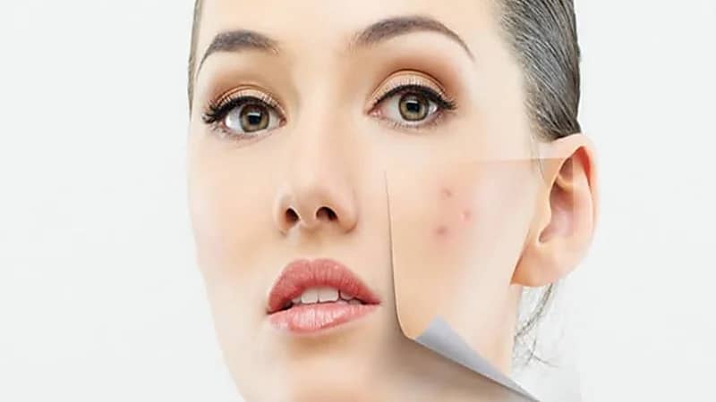 طرق الوقاية من إصابة البشرة بالبقع الداكنة