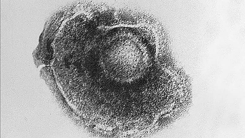 ظهور مرض خطير ينتشر أسرع من كورونا