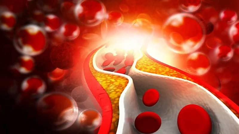 سعود الطبية توضح كيفية التحكم في كوليسترول الدم