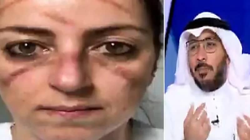 استشاري: الشخص المحصن بجرعتين علميًا غير ملزم بلبس الكمامة