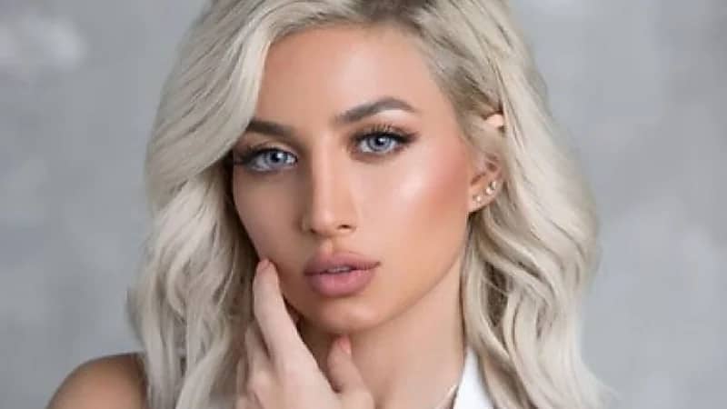 مودل روز عن اتهام طليقها بضربه : " وجه متنفخ من عملية زراعة الشعر"