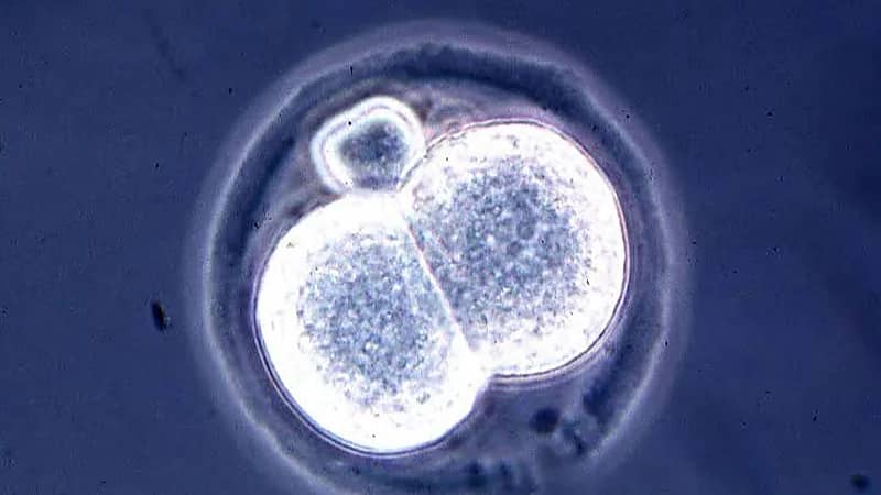 استشاري طب أجنة : لا يوجد كائن بشري حي تم استنساخه.. فيديو