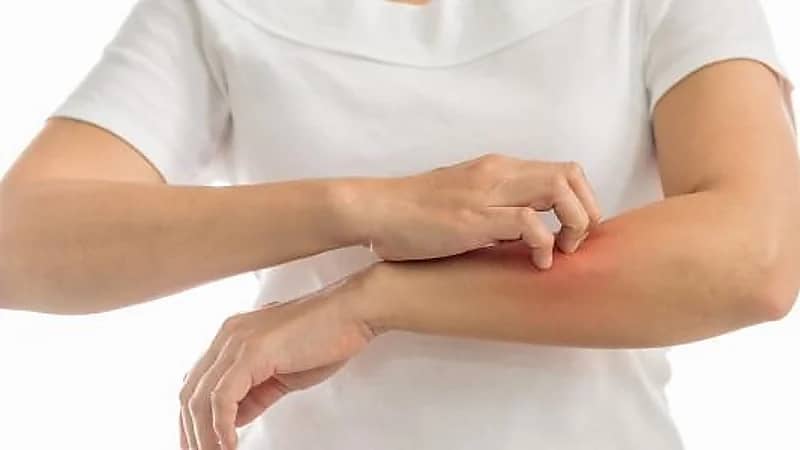 الشهري يوضح سبب الحكة الجلدية بعد ممارسة التمارين الرياضية .. فيديو