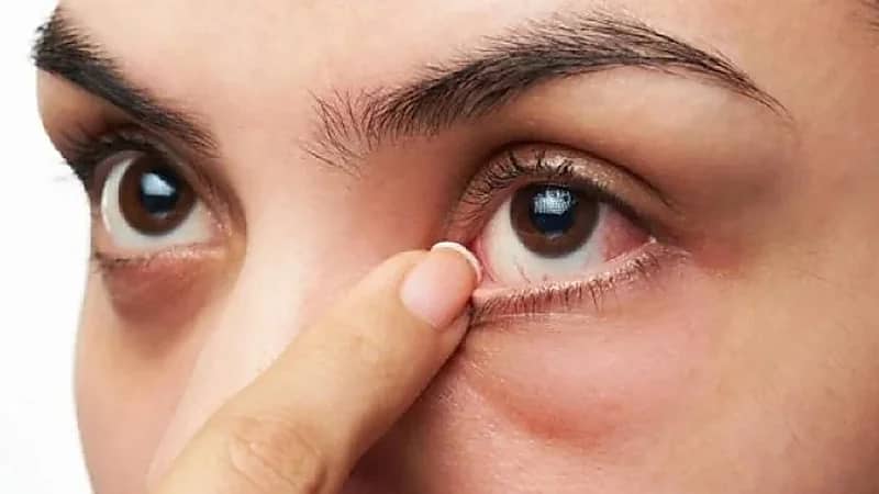 6 نصائح للوقاية من جفاف العين .. فيديو