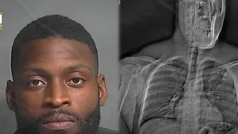 شاب يسرق أقراط فاخرة ويبتلعها لإخفاء الأدلة