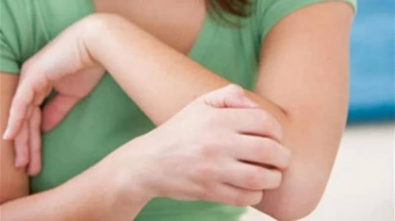 نصائح لتجنب الأمراض الجلدية خلال فصل الصيف