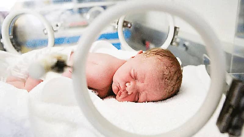 تقنية جديدة لفحص أدمغة المواليد الخدج