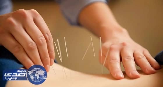 دراسة: الإبر اليابانية أدق وأفضل من الصينية