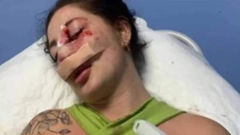 رجل مخمور ينقض على فتاة بالشارع ويشوه وجهها بدون سبب