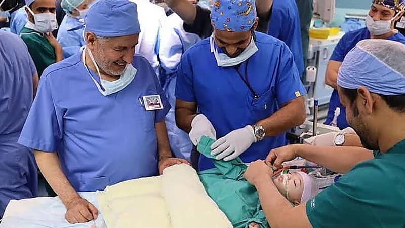 فصل السيامي إحسان وبسام تم بنجاح .. فيديو