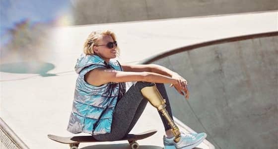 عارضة أزياء تفقد ساقها بسبب الانفلونزا