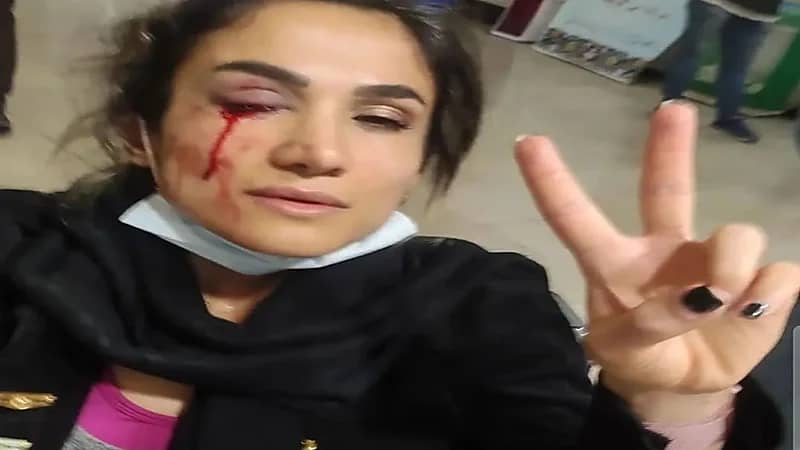 فتاة إيرانية تقاتل ضد نظام "الملالي" رغم فقدان إحدى عينيها