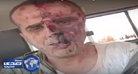 ⁠⁠⁠⁠⁠بالفيديو والصور.. لحظة القبض على طيار أسقطت المعارضة السورية طائرته