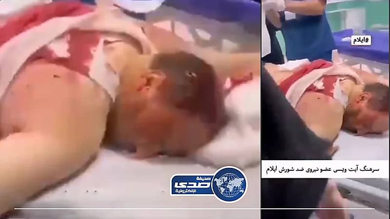 فيديو..إصابة جديدة في صفوف الحرس الثوري الإيراني واستقالات بالجملة