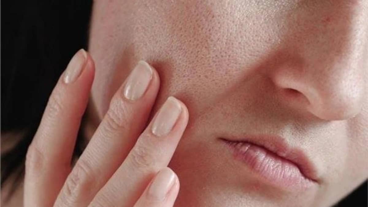 أمراض ترتبط بجفاف الجلد