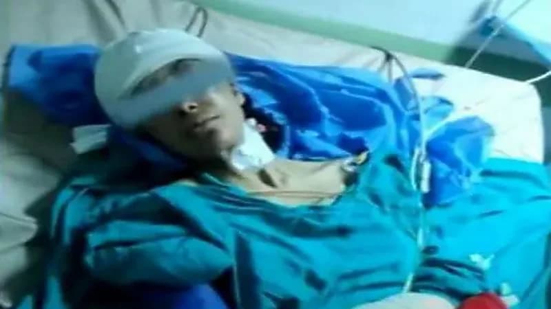 شاهد.. أول صور لاستخراج ساطور من رأس امرأة  تعرضت للضرب من ضرتها