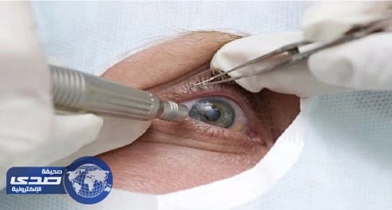 شاب صينى يستعيد الرؤية بعينه اليمنى بعد زرع قرنية خنزير