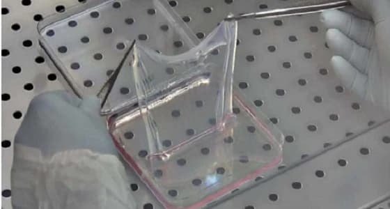 عملية معقدة تنقذ حياة طفل سوري من الموت بألمانيا