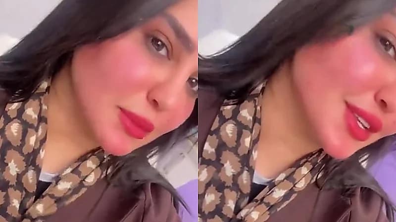 ميعاد العسيري تتغزل بنفسها بعد إجراء تجميلي: رجعت عروس يمديني أتزوج .. فيديو