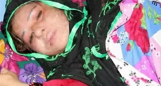 رجل يشوه وجه زوجته بـ " ماء النار " لإنجابها الإناث