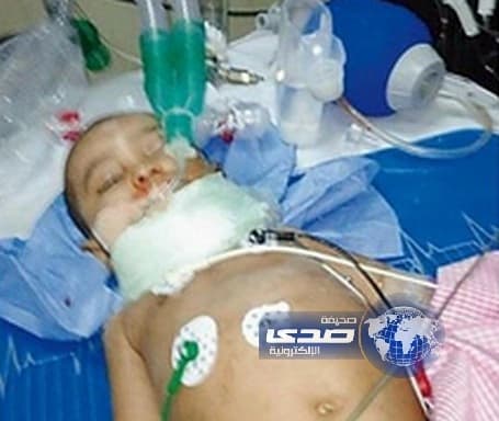 عنف جسدي يدخل رضيعا في غيبوبة