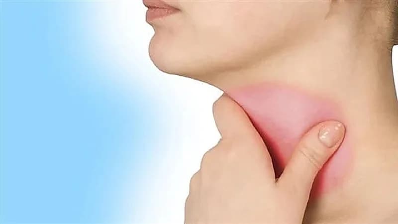 كيفية علاج بحة الصوت بالمنزل