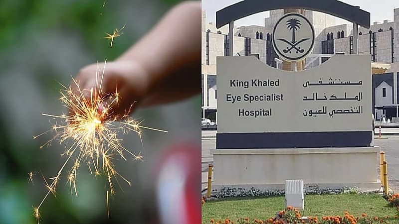 مستشفى الملك خالد يحذر من إصابات تصل لفقدان العين بسبب الألعاب النارية