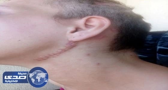 بالصور.. أوهمها بالحب ثم أجبرها على ممارسة الدعارة